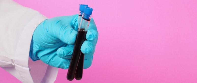 NHS to roll out world-first blood test for cancer
