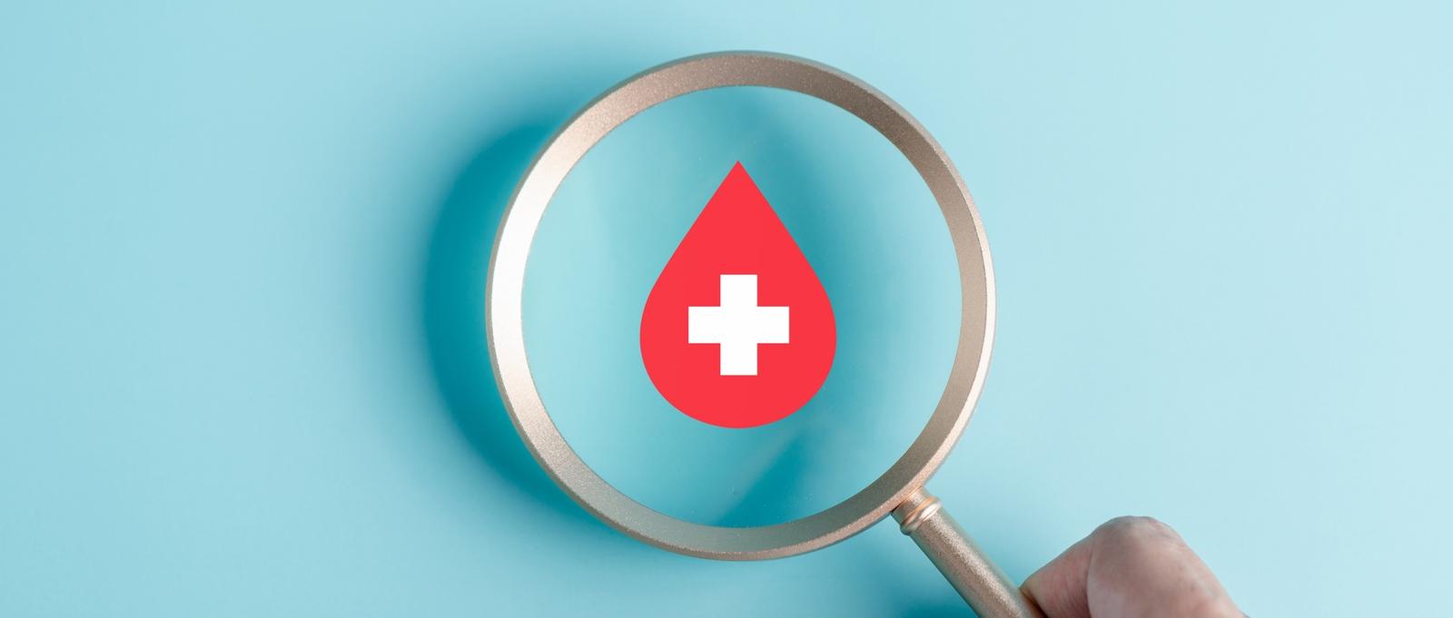 Signs you may have anaemia