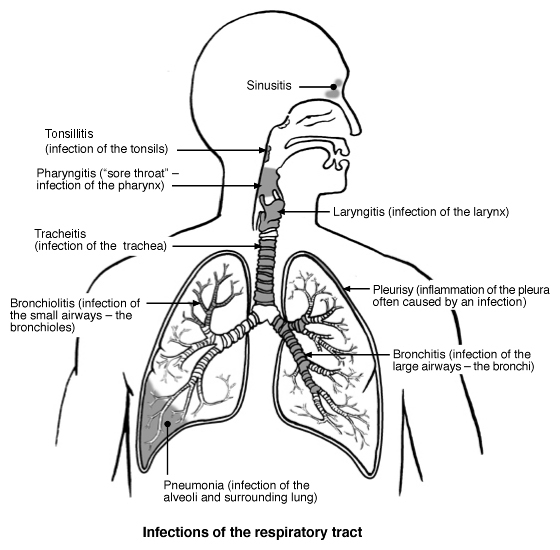 infections of the respiratory tract that can cause a chest infection