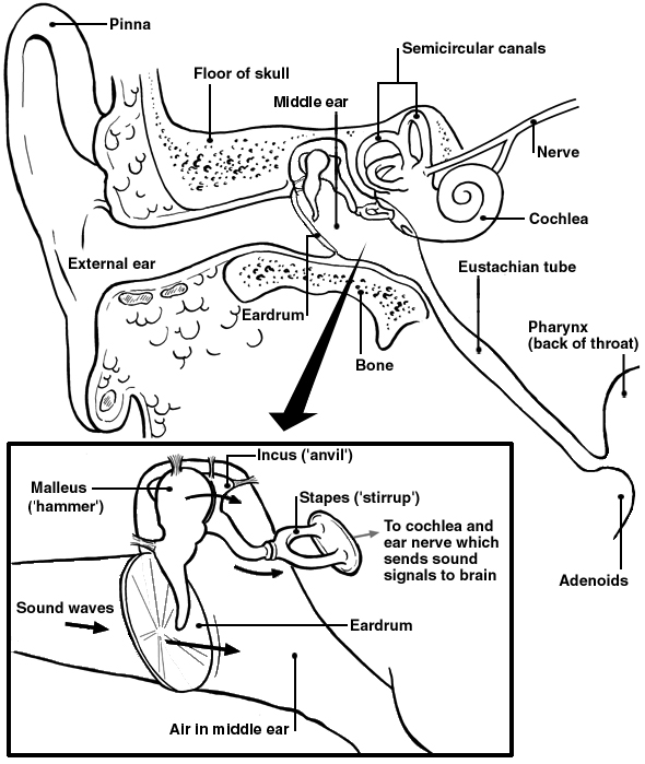 Otosclerosis