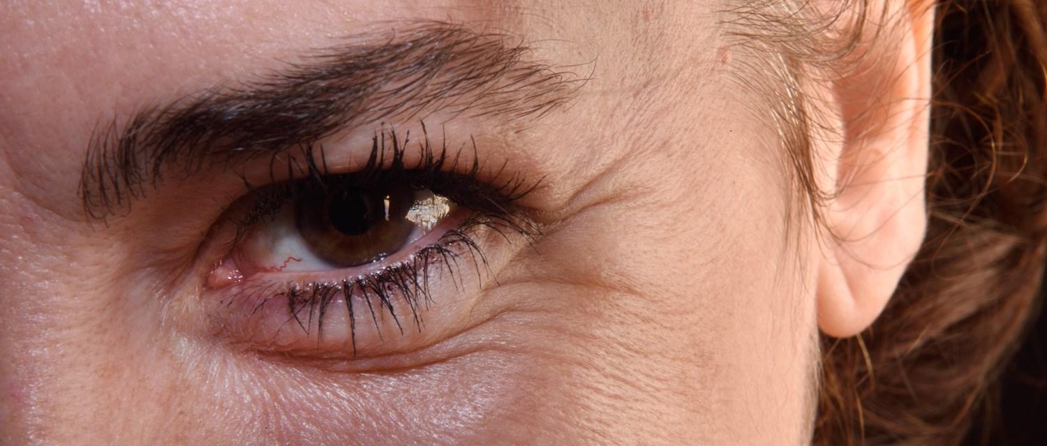 How your environment affects skin conditions