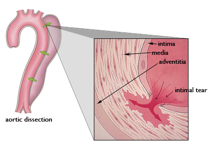 Aortic wall layers