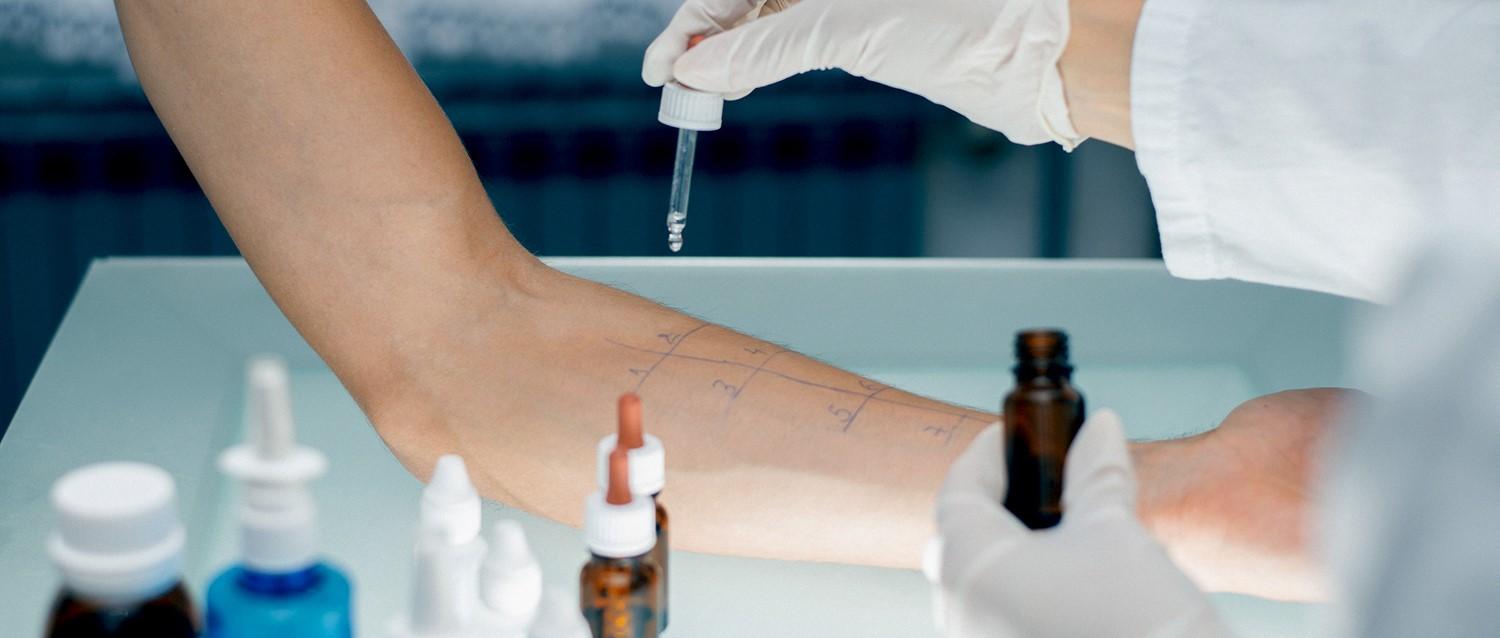 private allergy test
