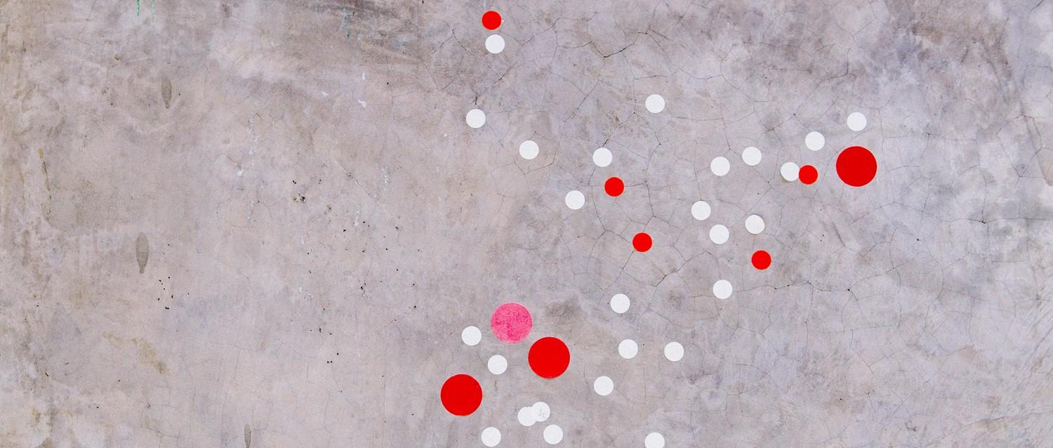 How to protect yourself from shingles