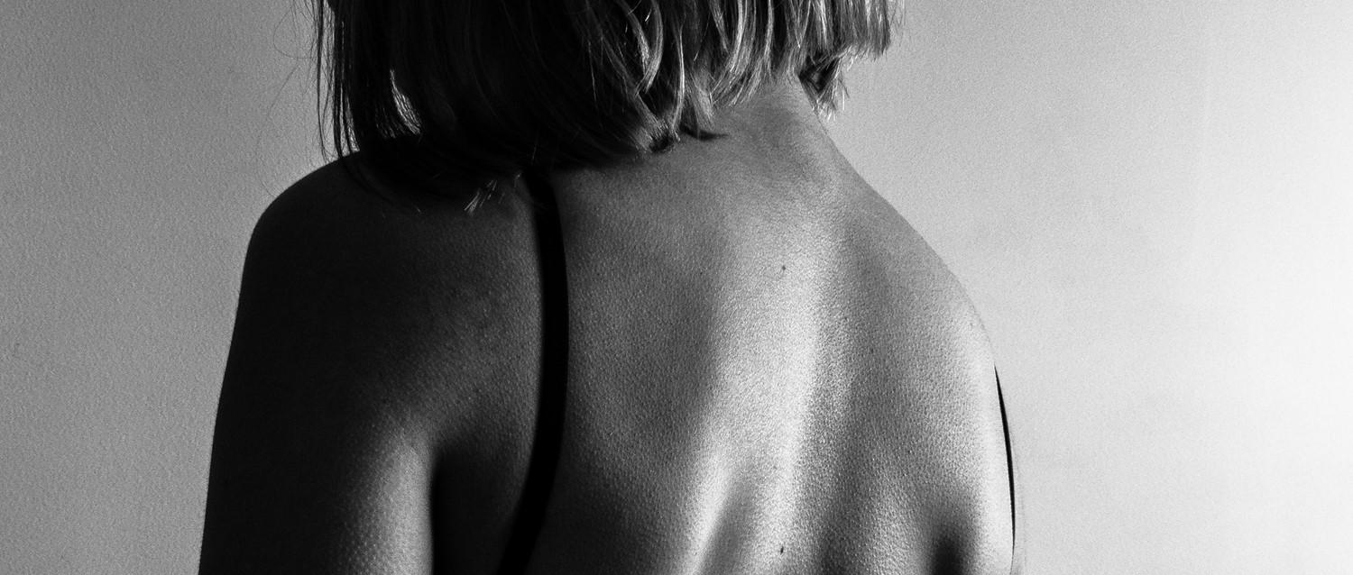 What to do if psoriasis is getting you down