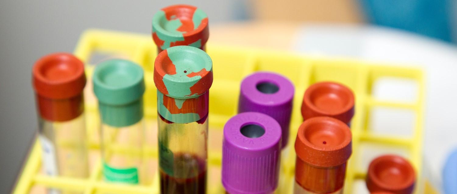 How to cope with a fear of blood tests